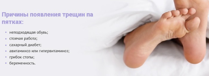 Medical pedicure. What is included in the procedure, price