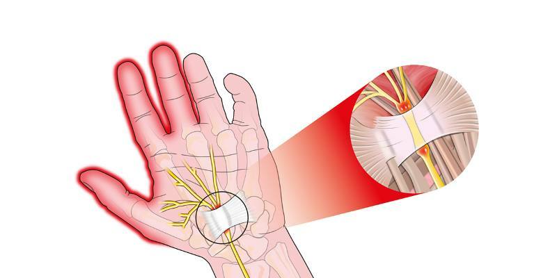 De ce sunt articulațiile degetelor dureroase și ce ar trebui să fac în acest caz?