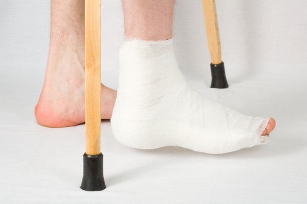 Ankle fracture. Rehabilitation at home after plaster removal, treatment, recovery period