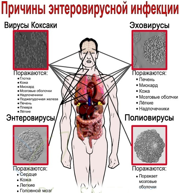 Enterovirus. Incubation period, symptoms and treatment