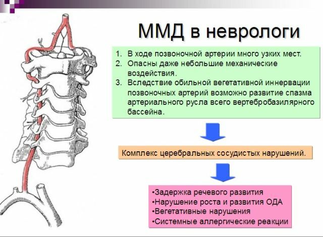 MMD neiroloģijā