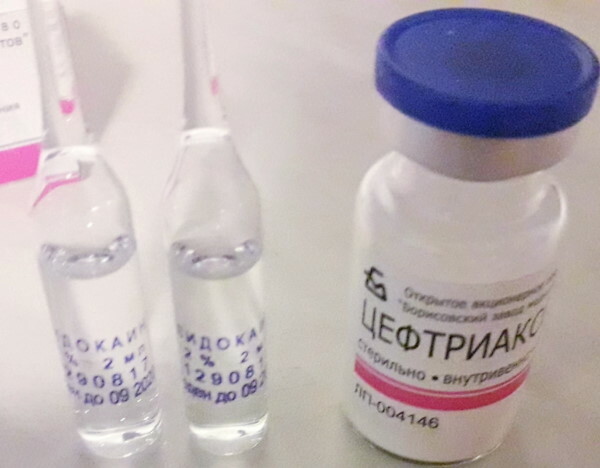 Cómo inyectar ceftriaxona con lidocaína correctamente en un adulto