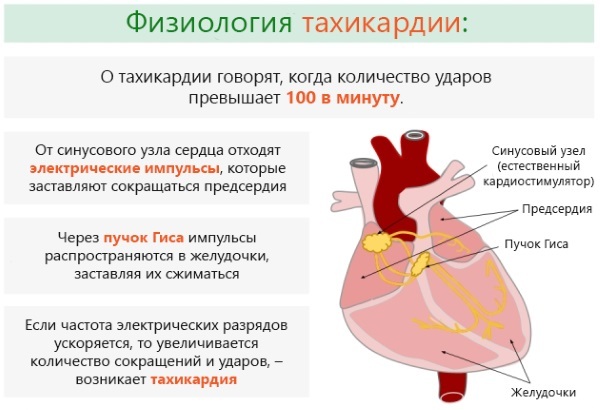 Taquicardia del corazón. Causas, síntomas y tratamiento.