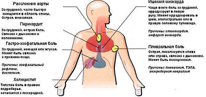 Burning pain in the sternum and burning in the middle, left, right. What is it
