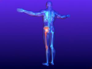 Inflammation of the sciatic nerve: causes, symptoms and treatment, prevention