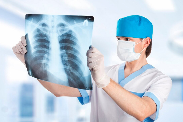Tuberculosis miliar: características generales de la enfermedad.