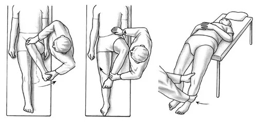 Síndrome de pinzamiento de la articulación de la cadera. Síntomas, signos, tratamiento.
