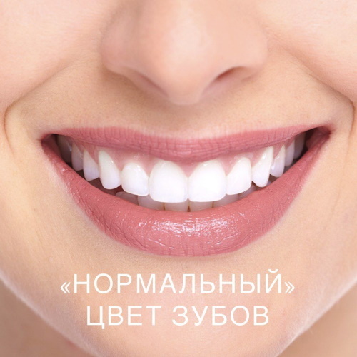 Vita dantų spalvų skalė. Nuotraukos, atspalviai pagal skaičius