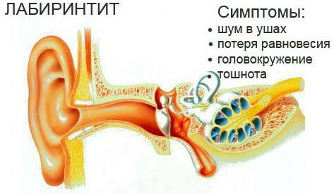 Svimmelhet og tinnitus. Årsaker hos kvinner, menn