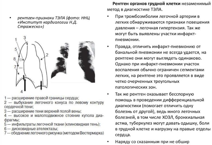 Radiografi af OGK. Hvad er det i 2 fremskrivninger, direkte projektion, forberedelse, afkodning, pris