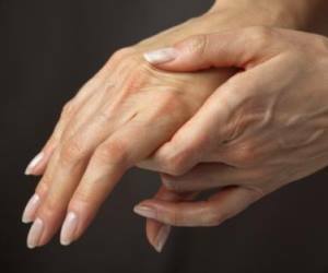 hånd polyarthritis