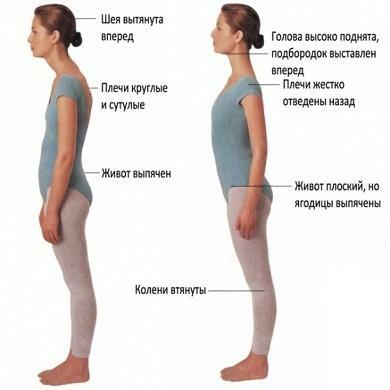 Cervical lordosis