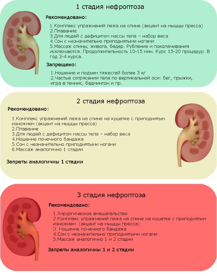 Descenso del riñón en mujeres. Síntomas y tratamiento, causas.