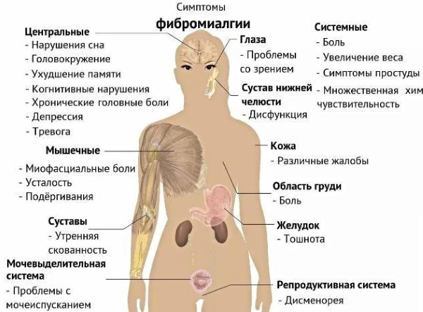 Pain in the muscles of the legs and arms. Causes, treatment, medicines, folk remedies, ointments