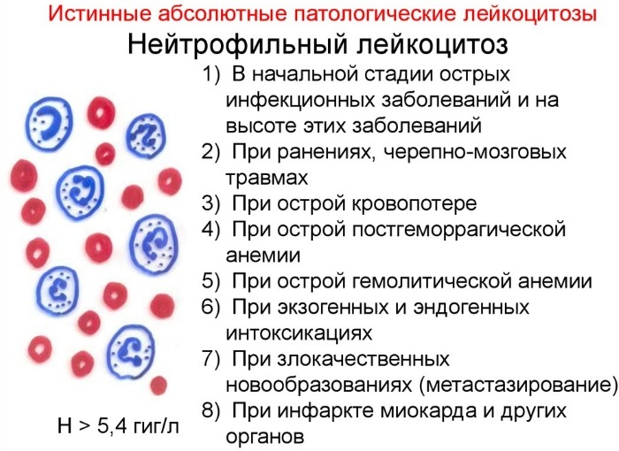 Blood leukocytosis. What is it in adults, children, pregnant women, causes, treatment, consequences