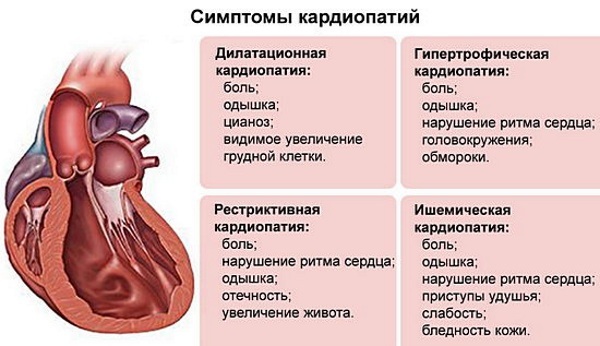 RMN-ul inimii. Ce arată cu și fără a contrasta, cum se face, mărturia
