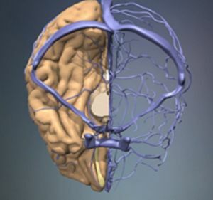 les veines et les vaisseaux du cerveau