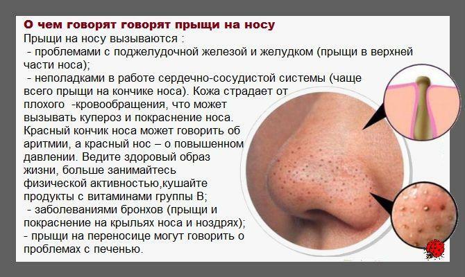 Årsager til acne på næsen