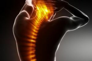 esclerose da coluna vertebral