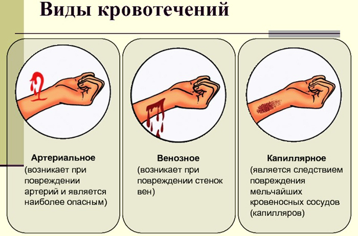 Aplicarea unui bandaj sub presiune. Algoritm pentru antebraț, picior inferior, umăr cu sângerări venoase, arteriale