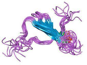 Tau proteina u Alzheimerovoj bolesti