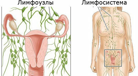 Inflammation des ganglions lymphatiques inguinaux chez les femmes