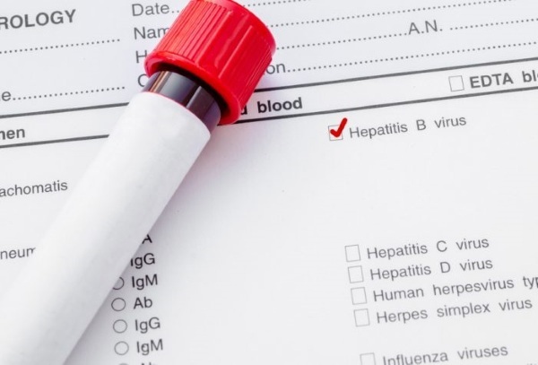 HBsAg blood test. What it means: negative, positive, transcript