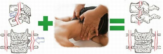 Massagem para osteocondrose da zona do colarinho