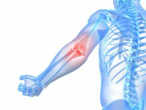 osteoarthritis of the elbow joint