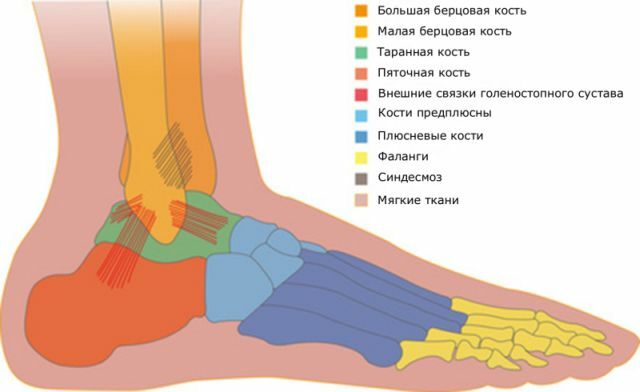 How to determine and cure the sprain of the foot?