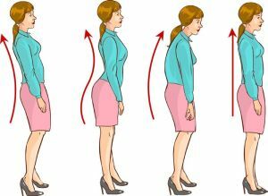 Correction of posture
