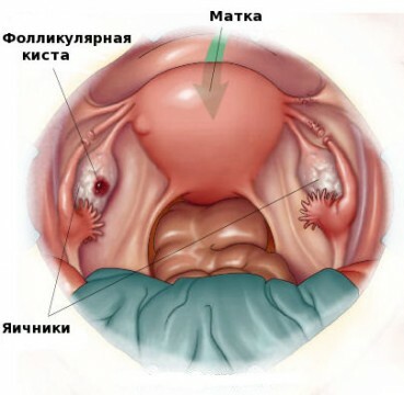 The follicular cyst