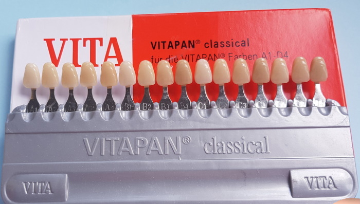 Vita -asteikko hampaiden väreissä. Valokuvat, sävyt numeroilla