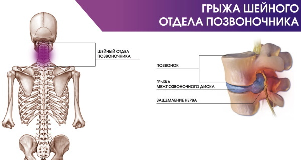 RMN al gâtului și laringelui, faringelui, esofagului. Ceea ce arată prețul la Moscova, Sankt Petersburg