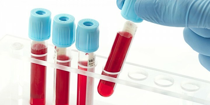 Test de sânge