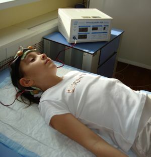 transcranial electrostimulation