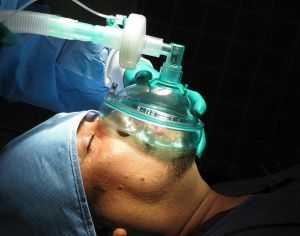 generell anestesi