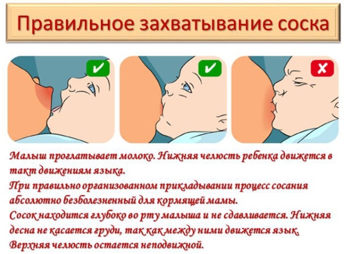 Vasospasme under amning. Hvad er det, symptomer, behandling, årsager, anmeldelser