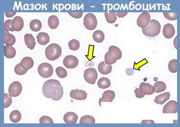 Platelets according to Fonio. Norm, what is it, how to pass