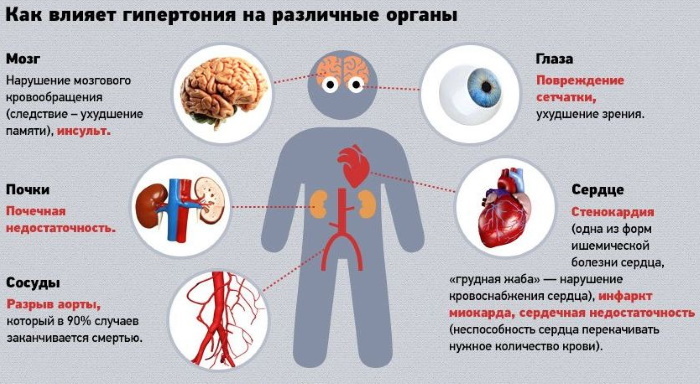 Hipertenzinė širdies liga. Etapas, rizikos laipsnis, priežastys, patogenezė, gydymas, klinikinius gaires