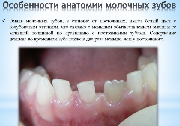 Vita škála barev zubů. Fotografie, odstíny podle čísel