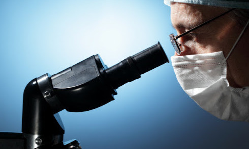 Analyserer sekretionen af ​​prostata under et mikroskop