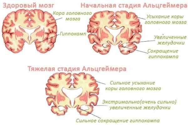 Ahli saraf dan ahli saraf: perbedaan, perbedaan, apa yang menyembuhkan