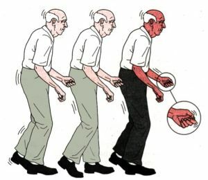 instabilité posturale