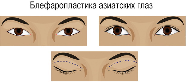 Human eye section: types, photos, nationality