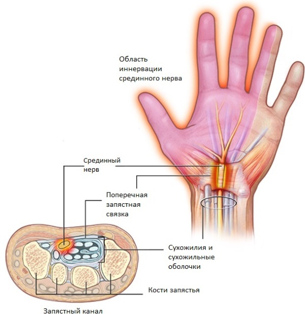 Human nerve endings. Scheme where they are, treatment