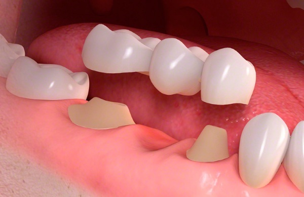 Ortopædisk tandlæge. Hvad gør en voksen, børns, forskellen med en ortodontist tandlæge