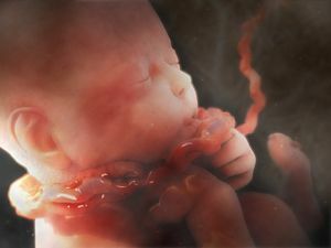 Hypoxie van de foetus