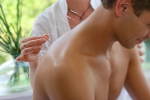 features of the procedure of acupuncture