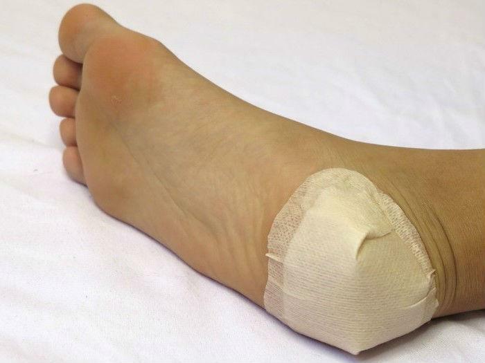 Fasten the compress on the heel with a plaster